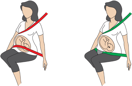 besafe pregnant izi fix